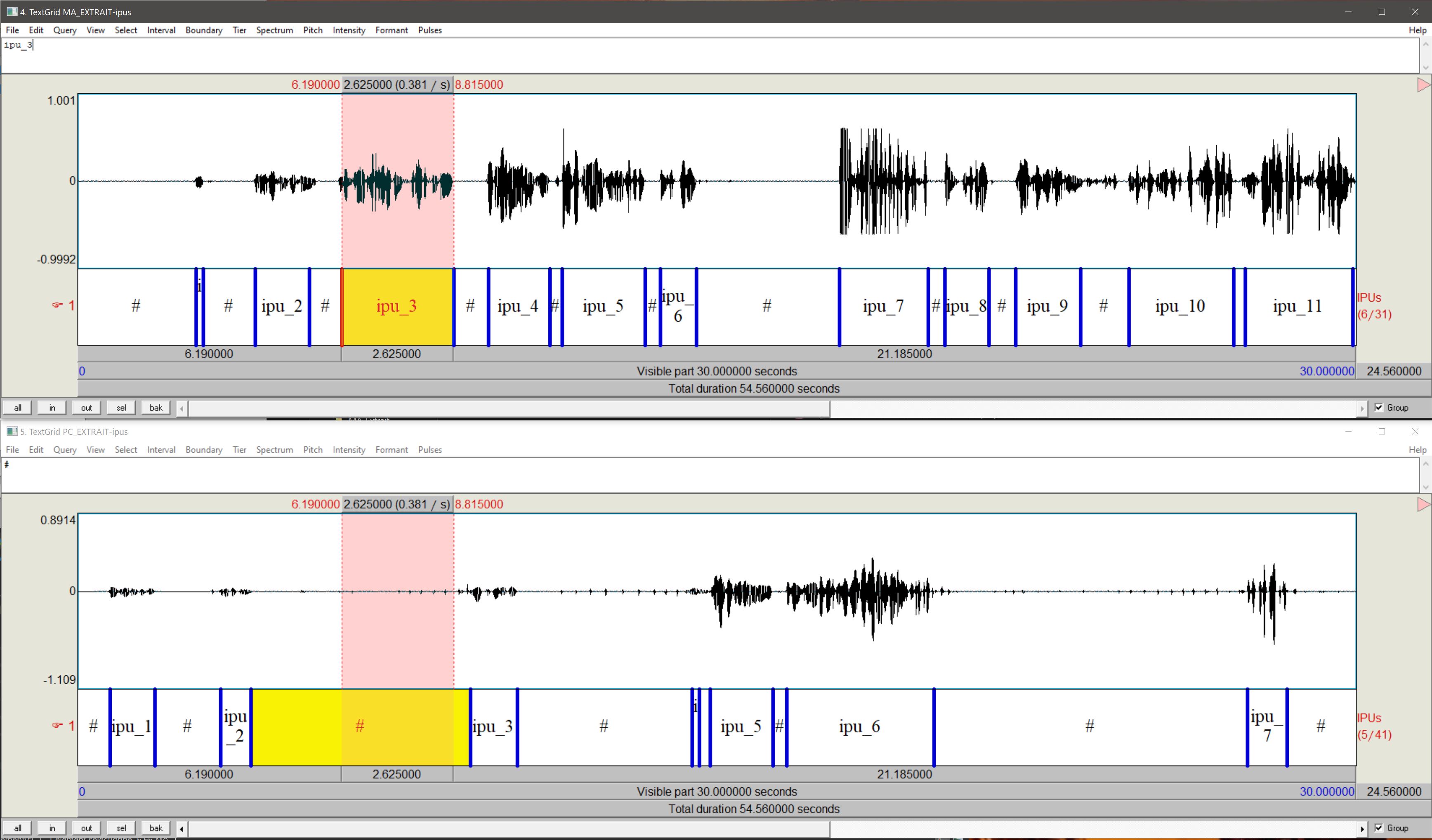 Audio waveform and IPUs