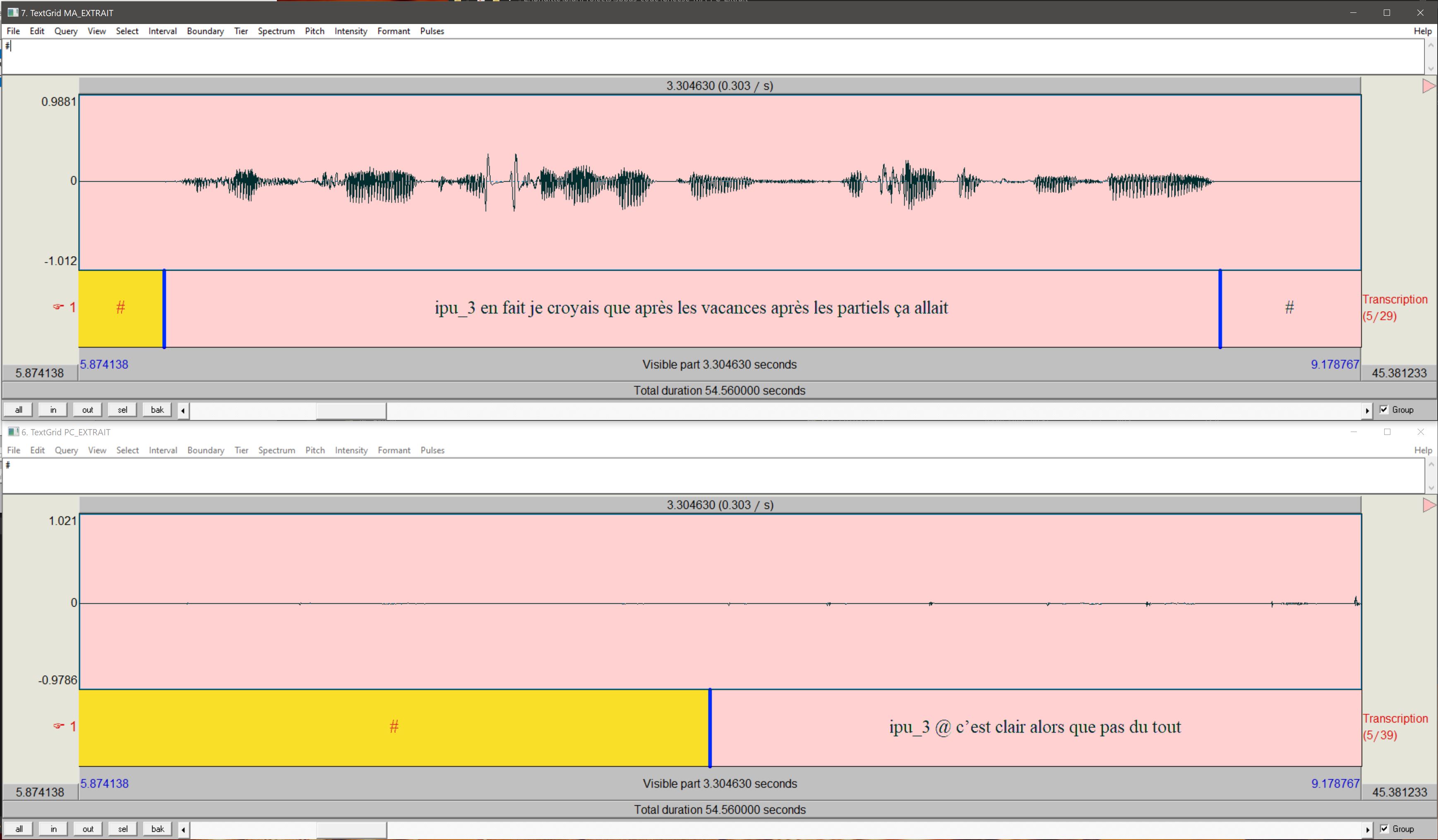 Audio waveform and Transcript